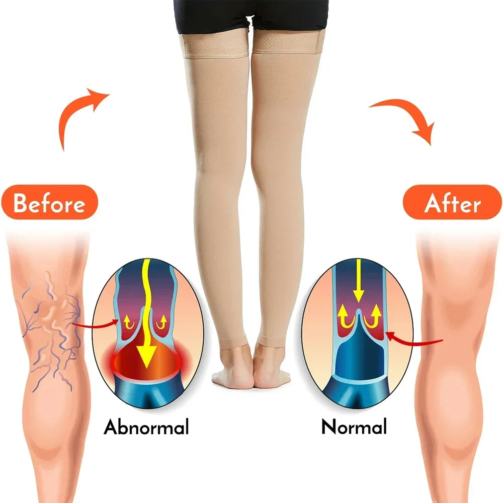 Medias de compresión